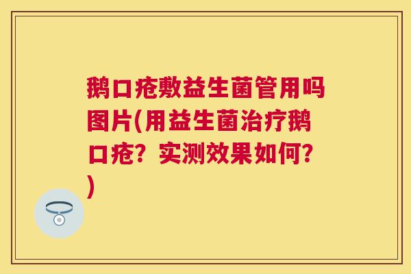 鹅口疮敷益生菌管用吗图片(用益生菌治疗鹅口疮？实测效果如何？)